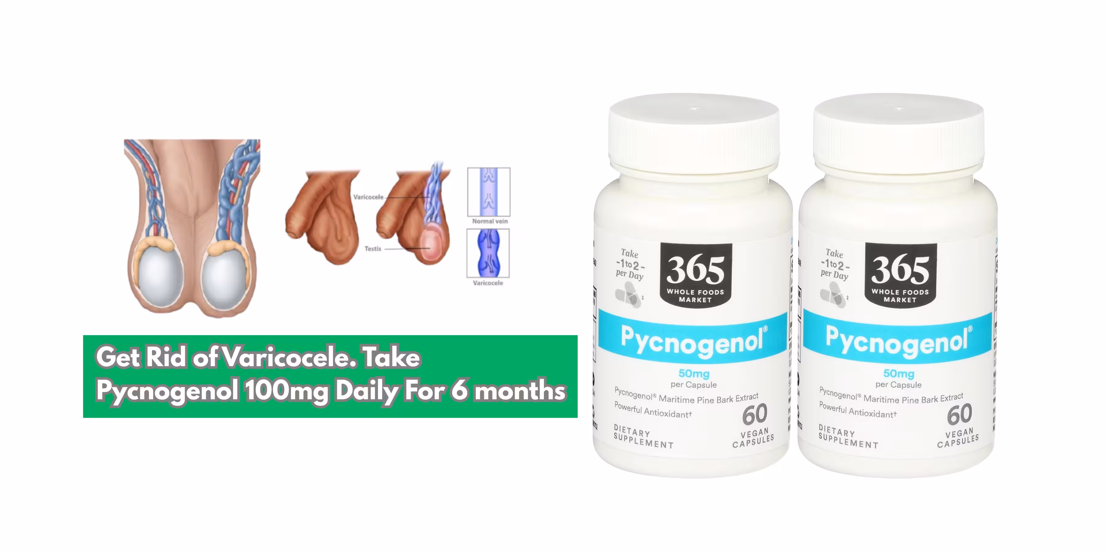 Pycnogenol supplement bottle with capsules, pine bark, and 6-month calendar for varicocele treatment