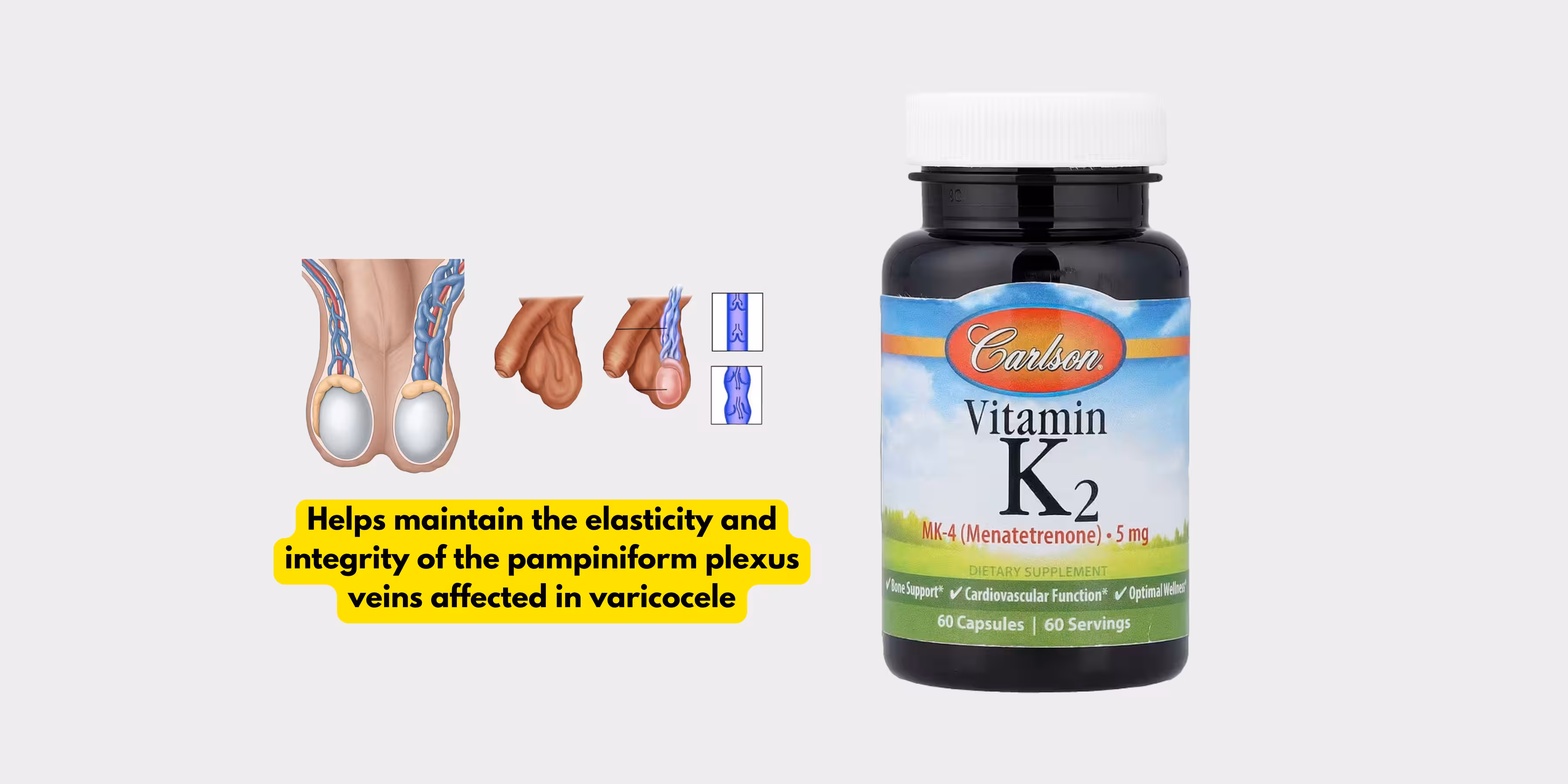 Vitamin k2 (5mg) best medicine for varicocele